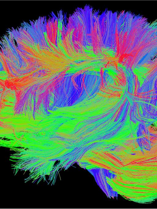 Eine Aufnahme von bunten Gehirnfasern.