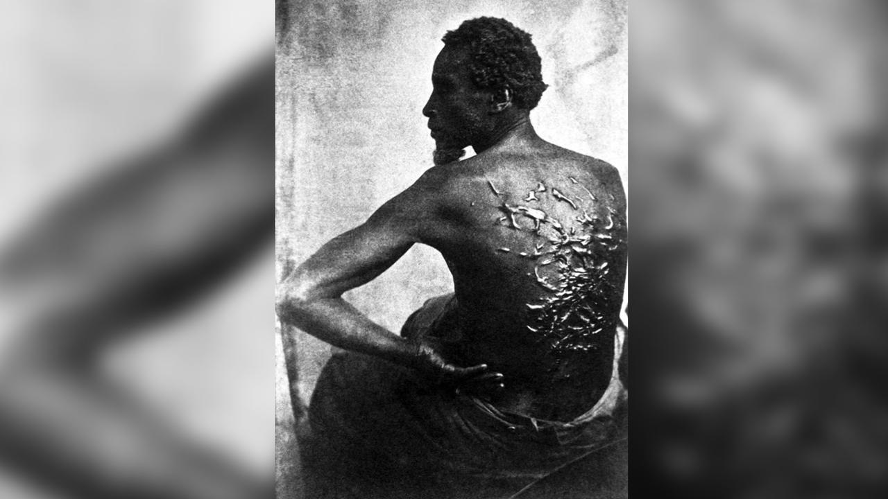 Ein Sklave zeigt zeigt seinen von Peitschenhieben vernarbten Rücken.
      