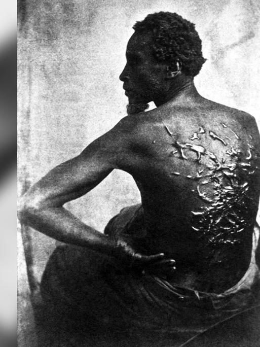 Ein Sklave zeigt zeigt seinen von Peitschenhieben vernarbten Rücken.
      