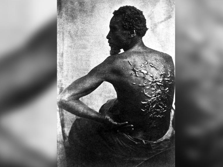 Ein Sklave zeigt zeigt seinen von Peitschenhieben vernarbten Rücken.
      