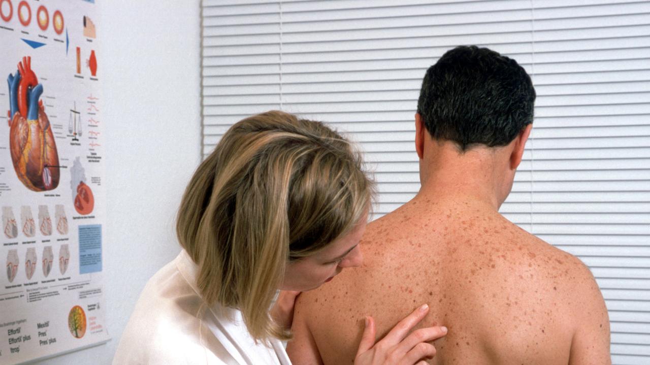 Mann beim Hautarzt, Dermatologe, Dermatologin, untersucht Haut, Hautveraenderungen auf Rücken, Hautkrebs, Hautkrebsvorso