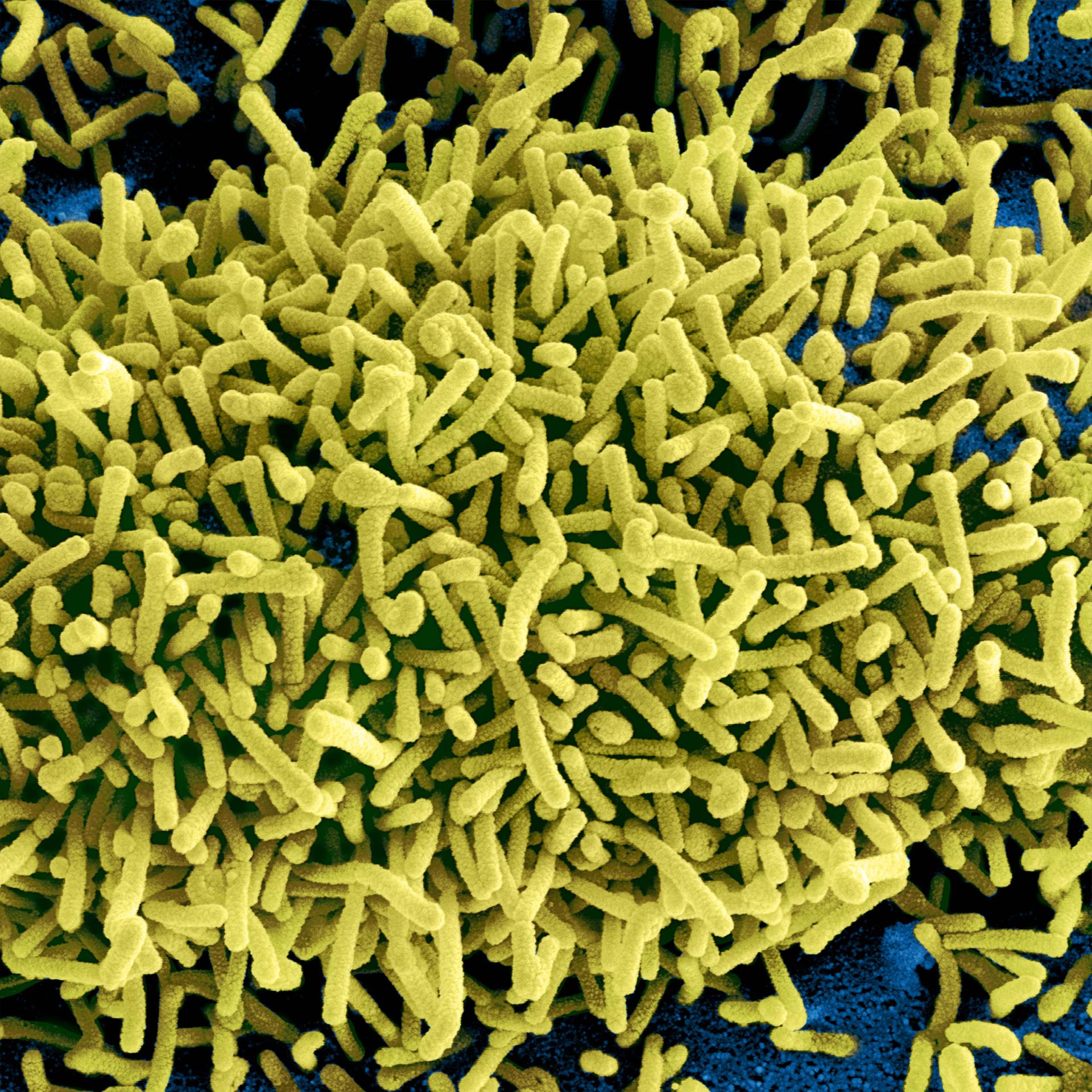 Ostafrika - Marburg-Virus: Ausbruch in Äthiopien laut Weltgesundheitsorganisation eingedämmt