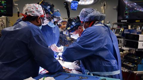 Ärzte während der ersten Transplantation eines Schweineherzens in einen Menschen
