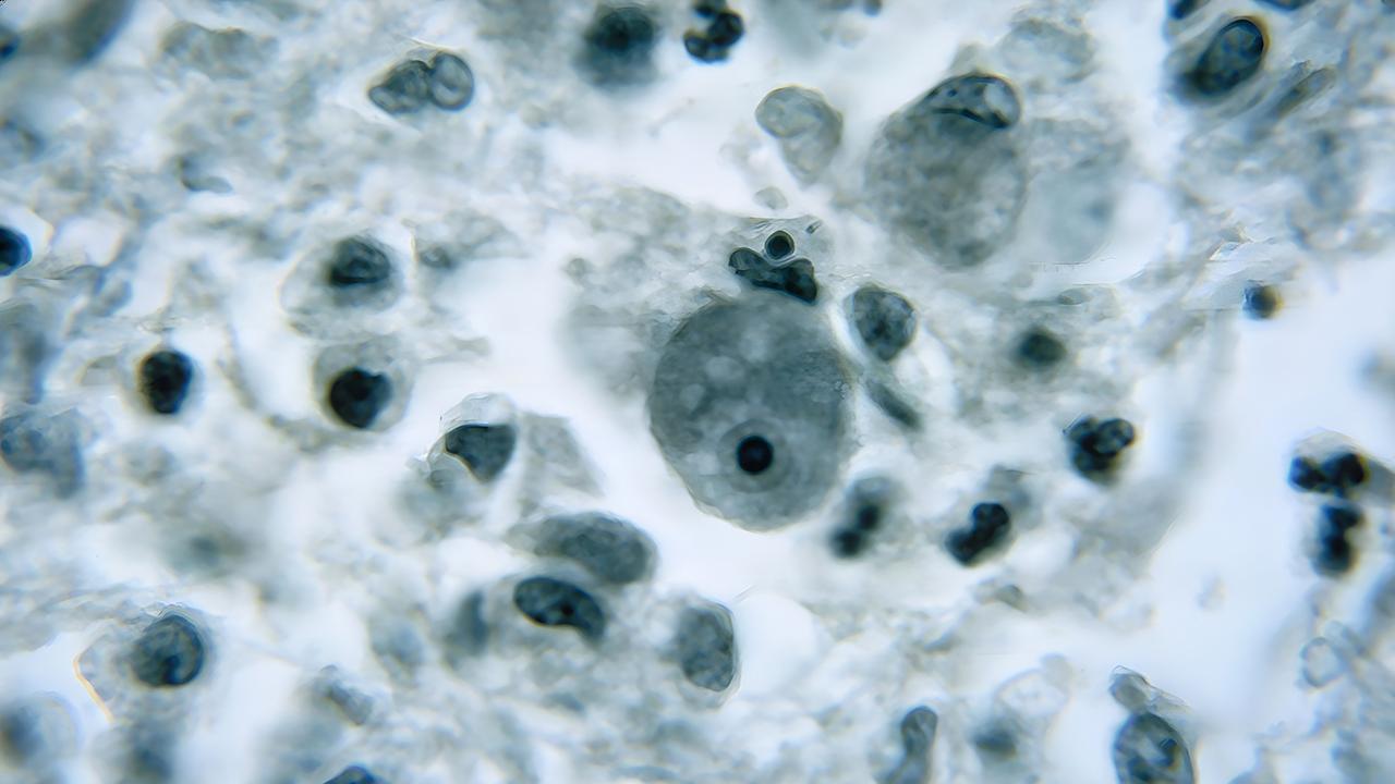 Eine Mikrosop-Aufnahme der "hirnfressenden Amöbe", Naegleria fowleri