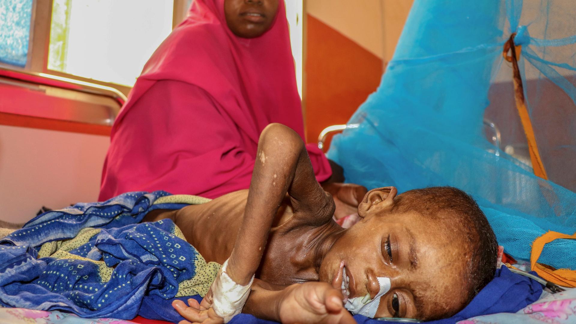 Eine Mutter sitzt mit ihren sehr dünnen, ausgemergelten Kind in einem Krankenhaus in Somalia. Eine Mutter sitzt mit ihren sehr dünnen, ausgemergelten Kind in einem Krankenhaus in Somalia.