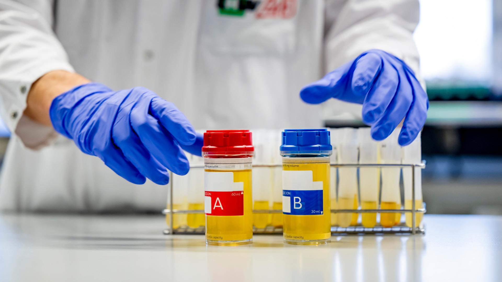 Zwei Probenbehälter mit gelblicher Flüssigkeit, beschriftet mit „A“ und „B“, stehen auf einem Tisch, dahinter eine Person in einem weißen Laborkittel und blauen Schutzhandschuhen.