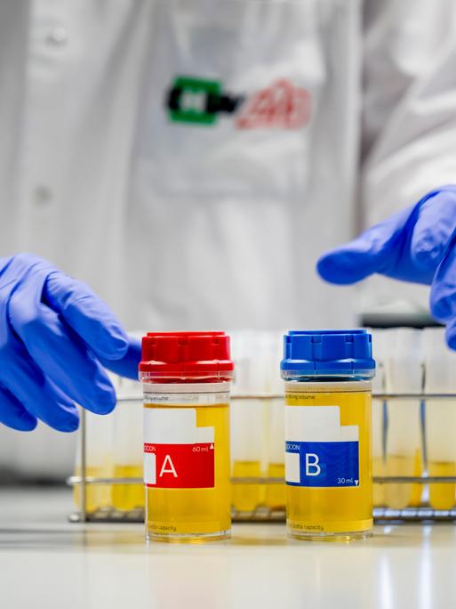 Zwei Probenbehälter mit gelblicher Flüssigkeit, beschriftet mit „A“ und „B“, stehen auf einem Tisch, dahinter eine Person in einem weißen Laborkittel und blauen Schutzhandschuhen.