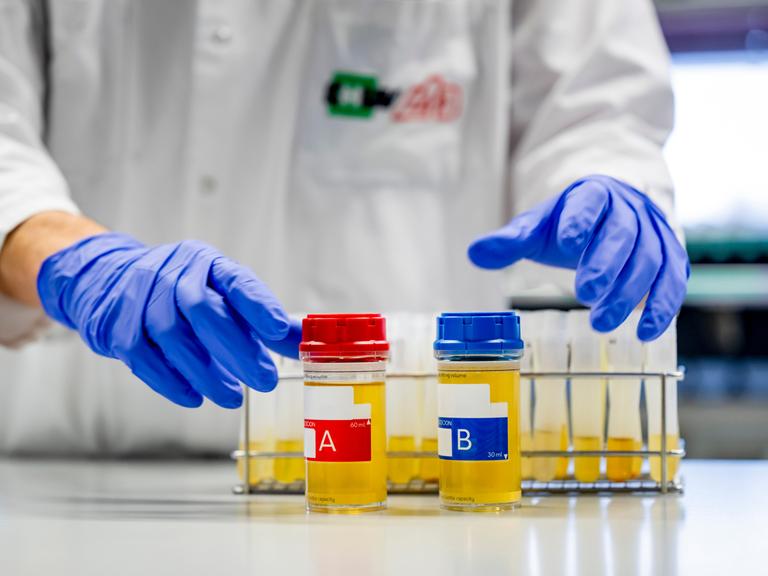 Zwei Probenbehälter mit gelblicher Flüssigkeit, beschriftet mit „A“ und „B“, stehen auf einem Tisch, dahinter eine Person in einem weißen Laborkittel und blauen Schutzhandschuhen.