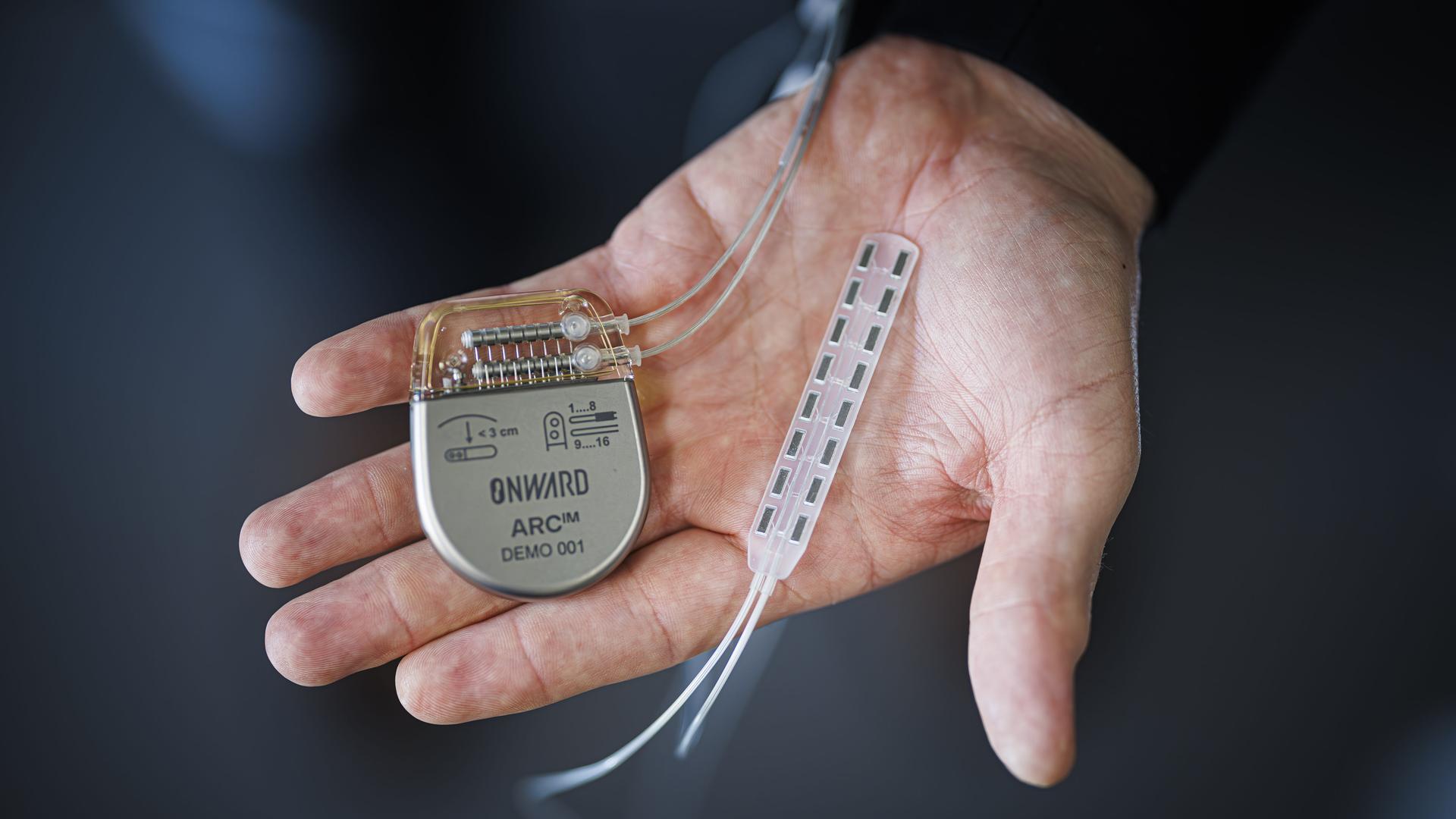 Rückenmarks-Neuropropthese, bestehend aus Elektroden und einem Controller, präsentiert auf einem Handteller.