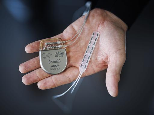Rückenmarks-Neuropropthese, bestehend aus Elektroden und einem Controller, präsentiert auf einem Handteller.