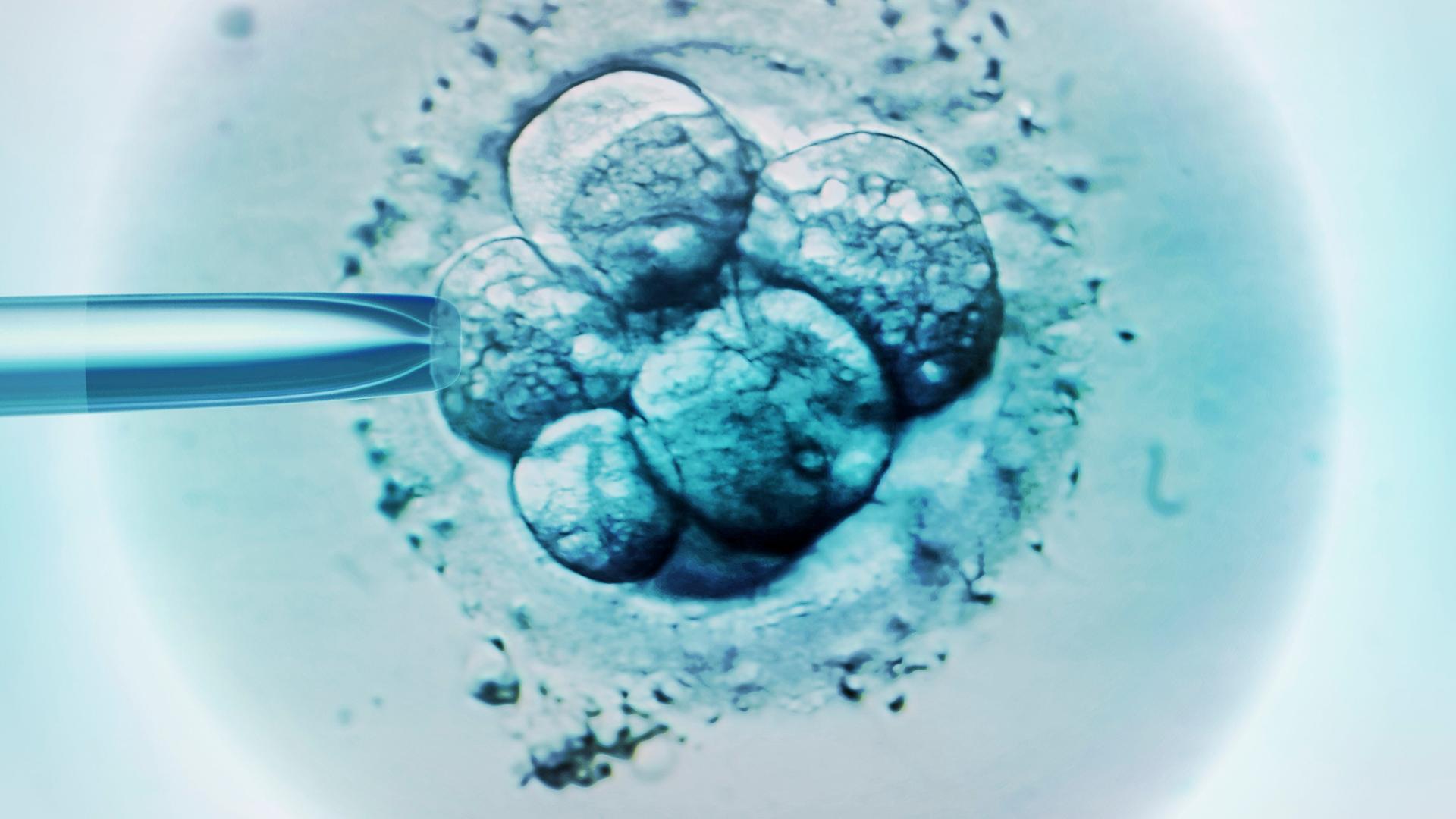 Mikroskopaufnahme einer Befruchtung in der Petrischale Mikroskopaufnahme einer Befruchtung in der Petrischale