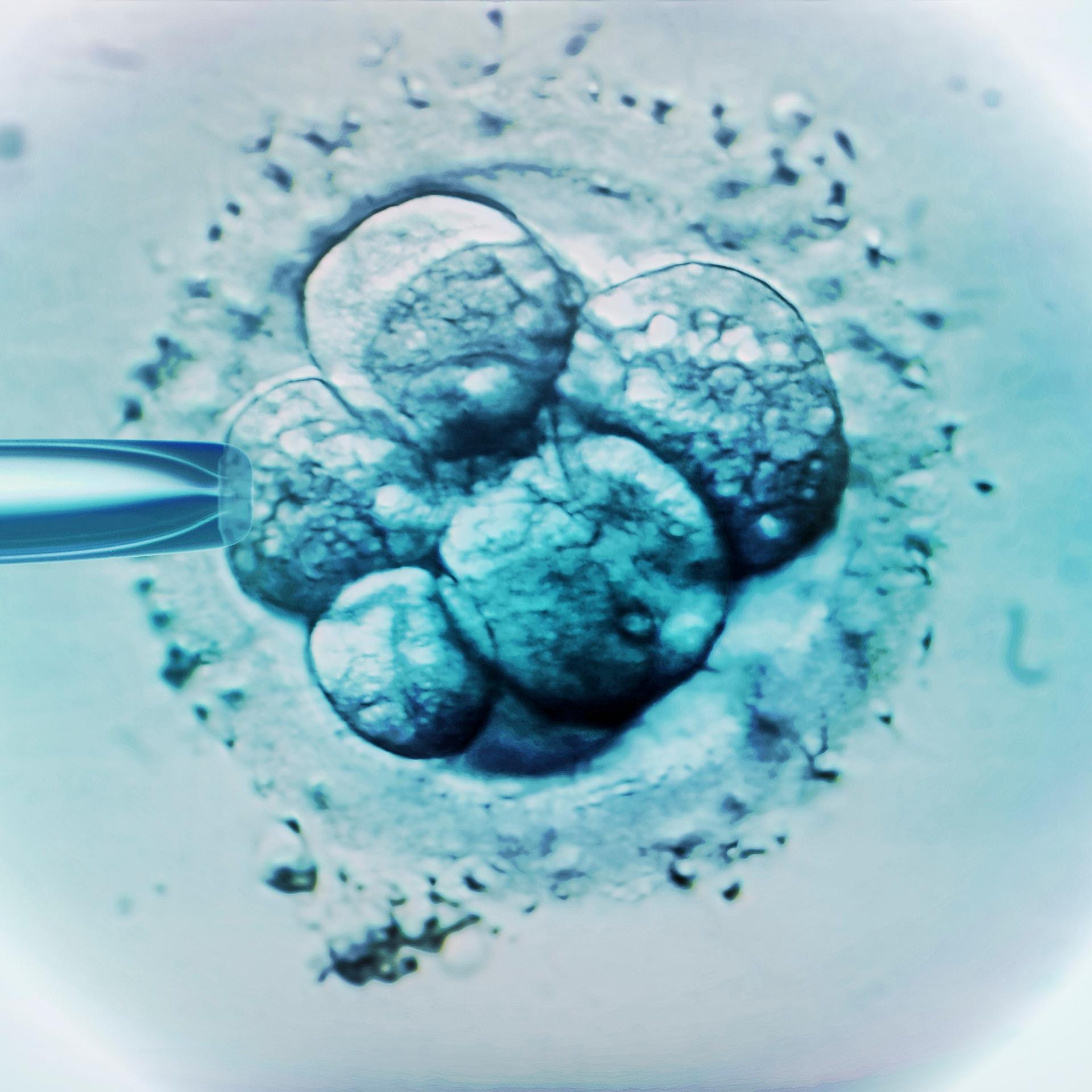 Kinderwunsch - Geschlecht auf Bestellung in Nordzypern