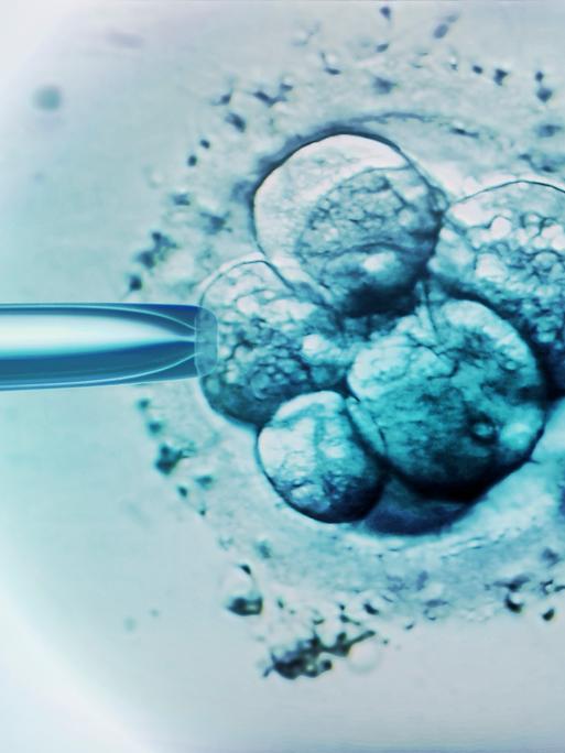 Mikroskopaufnahme einer Befruchtung in der Petrischale