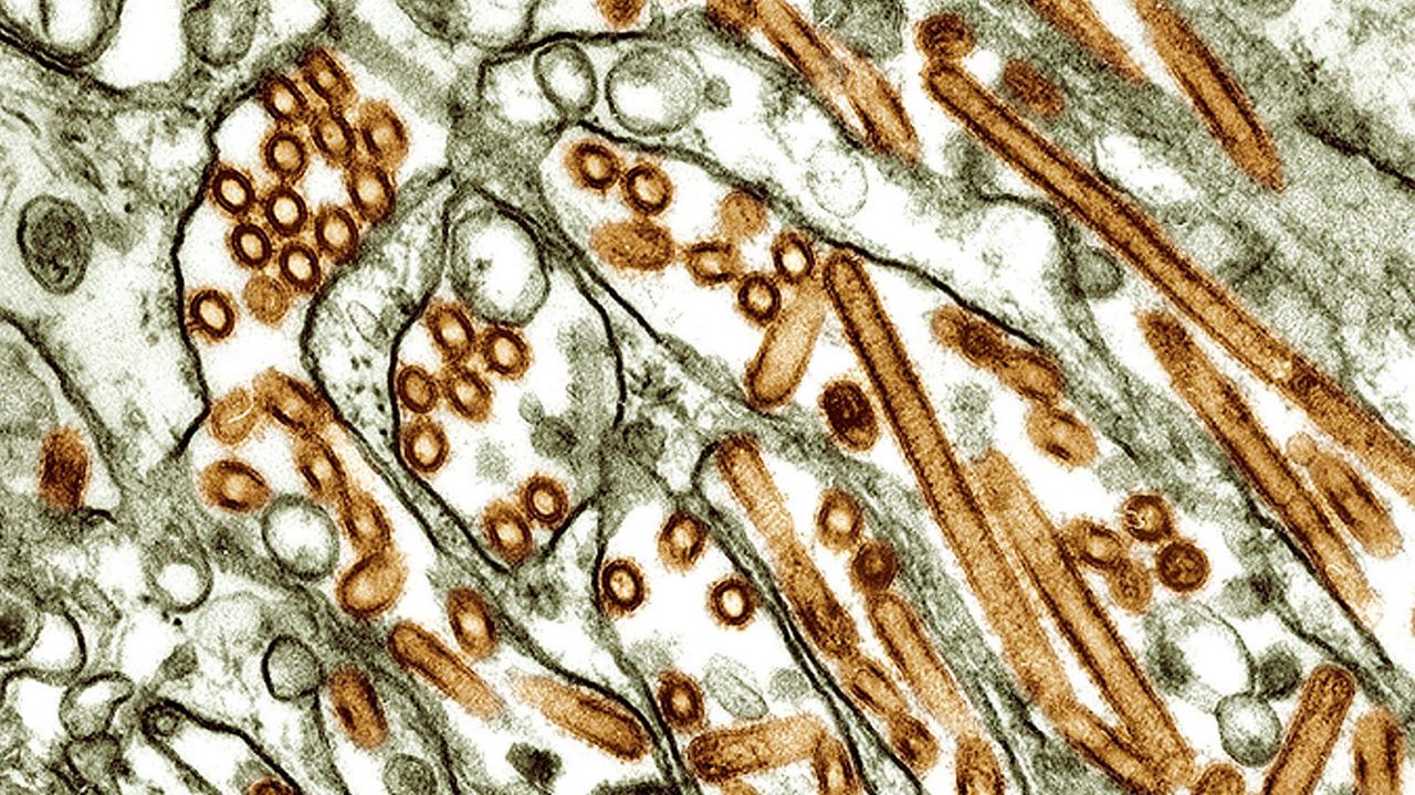 Die Aufnahme zeigt bräunlich eingefärbte runde und stäbchenförmige Virus-Strukturen. 