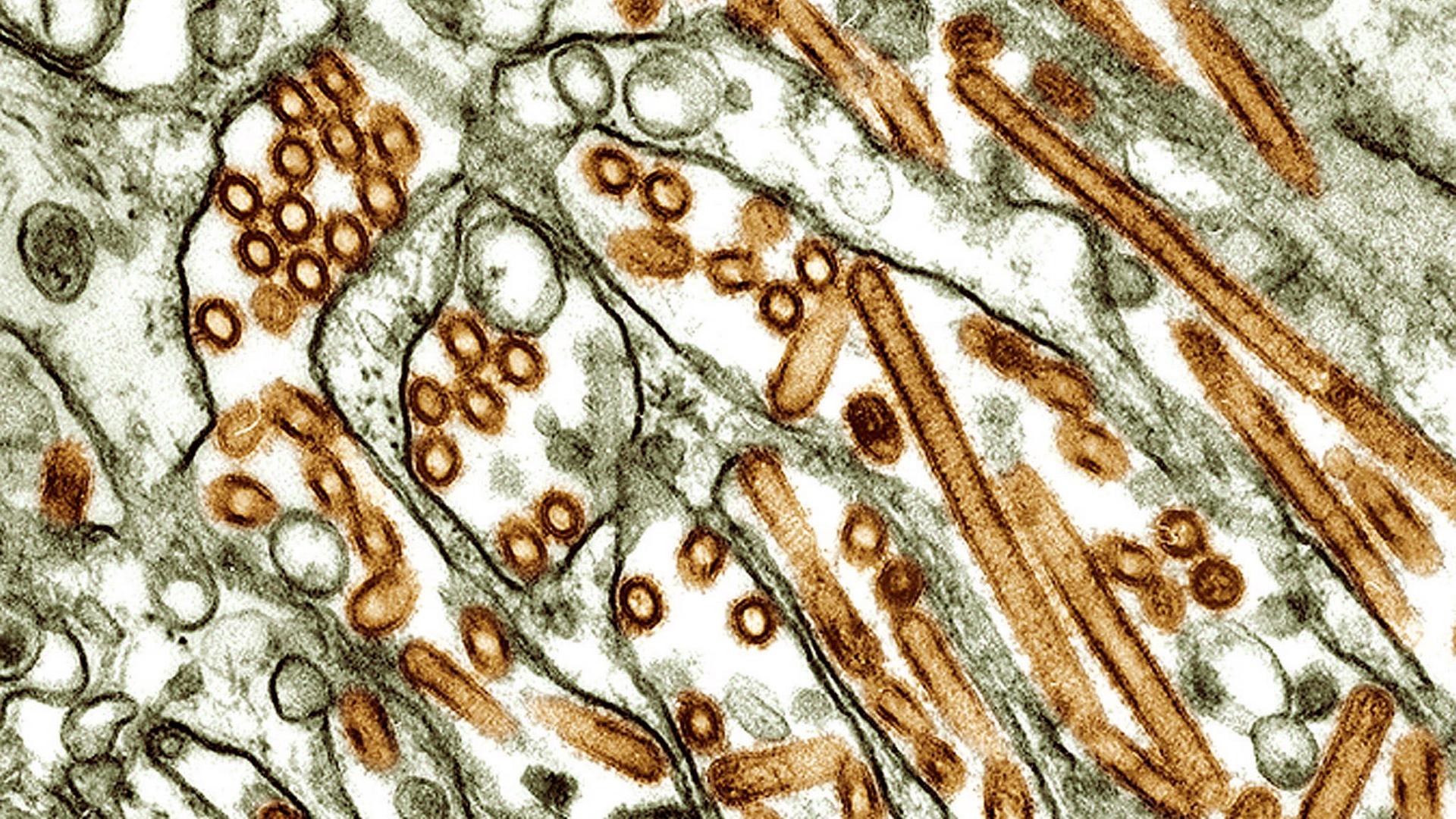 Elektronenmikroskop-Aufnahme zeigt bräunlich eingefärbte runde und stäbchenförmige Strukturen des Vogelgrippe-Virus. 