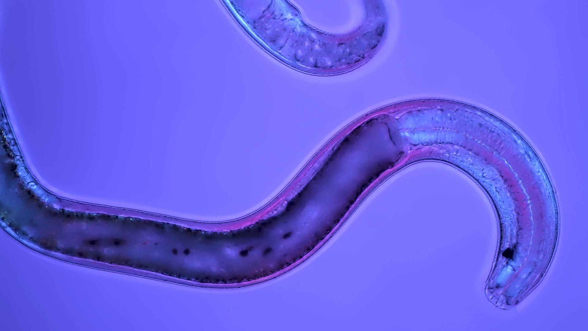 Fadenwurm, Nematode (Nematoda) Fadenwurm, Nematode (Nematoda)