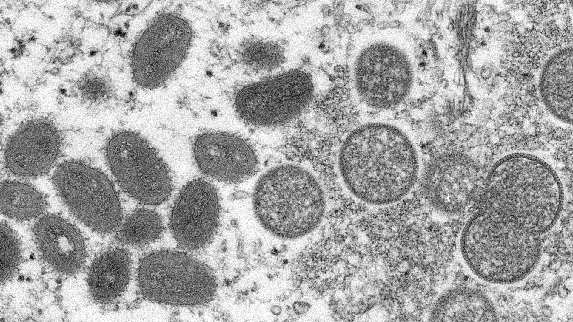 Die elektronenmikroskopische Aufnahme von den Centers for Disease Control and Prevention aus dem Jahr 2003 zeigt reife, ovale Affenpocken-Viren und kugelförmige unreife Virionen aus einer menschlichen Hautprobe. 