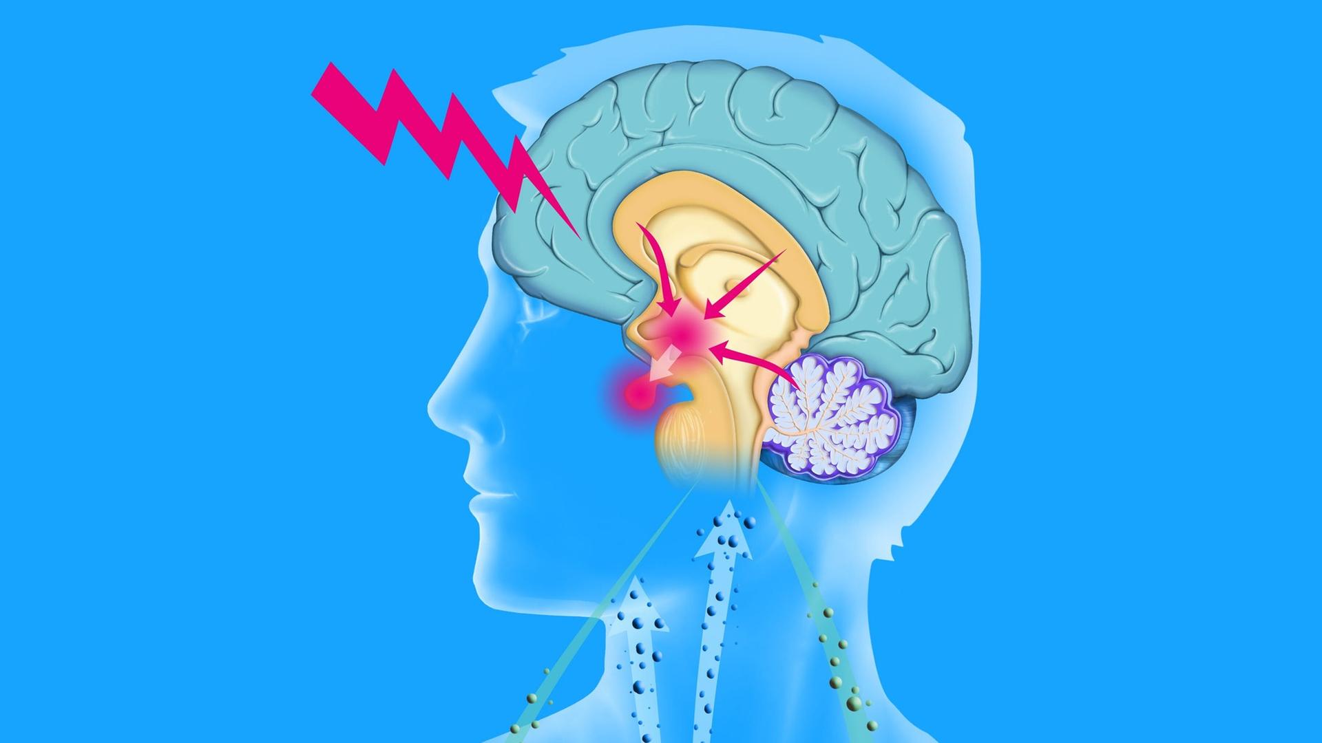 Eine grafische Illustration stellt die die Auswirkungen von Stress auf den Organismus dar. Eine grafische Illustration stellt die die Auswirkungen von Stress auf den Organismus dar.