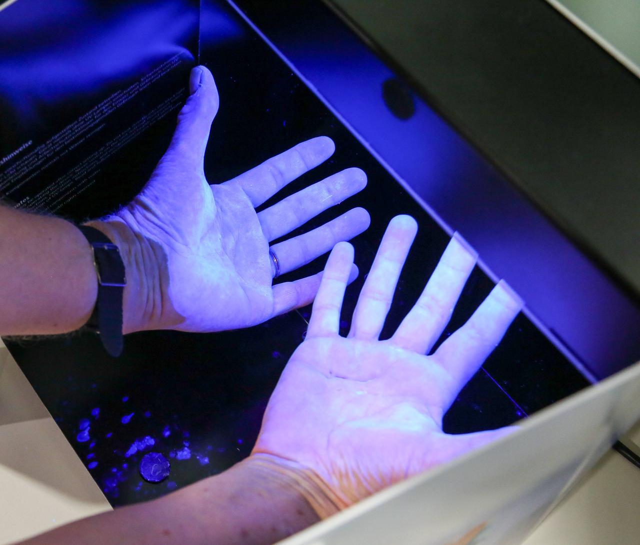 Krankenhaushygiene in einem Bonner Krankenhaus: UV Licht macht Verschmutzungen an den Händen sichtbar.