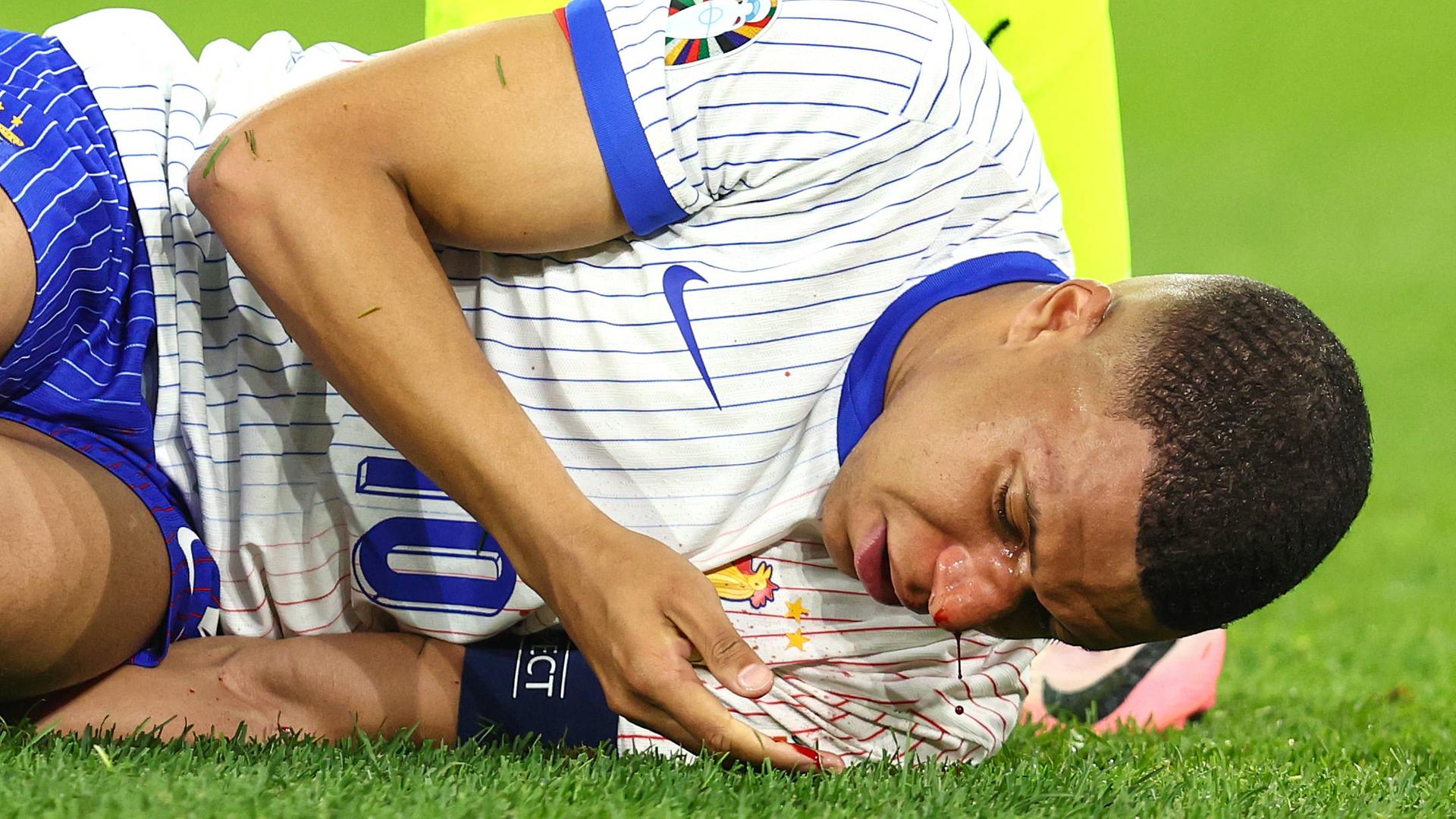 Frankreich-Superstar Kylian Mbappé liegt mit blutender Nase auf dem Boden beim EM-Spiel Frankreich gegen Österreich.