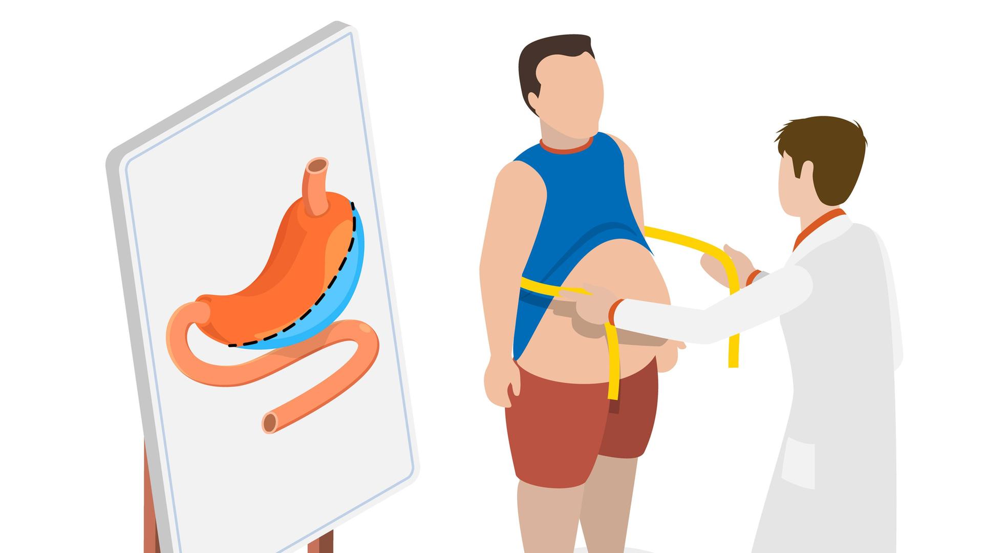 Auf einer lllustration misst ein Arzt in einem weißen Kittel den Bauchumfang eines fettleibigen Patienten. Daneben steht eine Tafel, auf der ein Bild eines Magens abgebildet ist. 