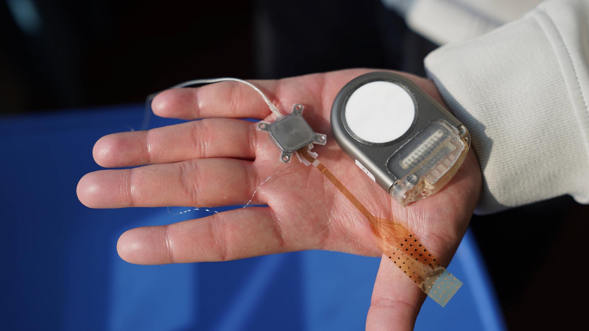 Eine offene Hand hält ein Implantat mit Kabel. Eine offene Hand hält ein Implantat mit Kabel.