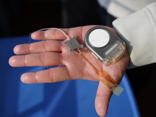 Eine offene Hand hält ein Implantat mit Kabel. Eine offene Hand hält ein Implantat mit Kabel.