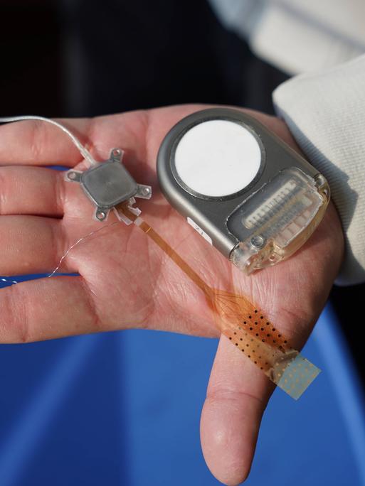 Eine offene Hand hält ein Implantat mit Kabel. Eine offene Hand hält ein Implantat mit Kabel.