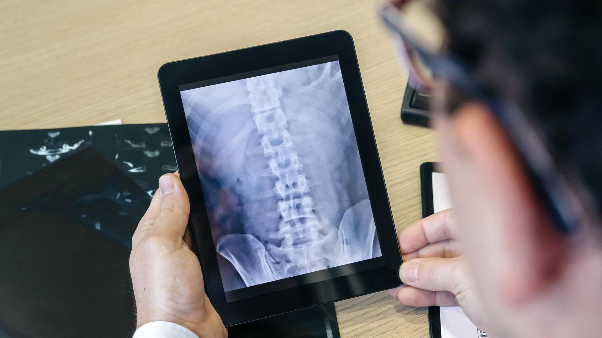 Eine Person hält ein Ipad in der Hand auf der ein Röntgenbild zu sehen ist