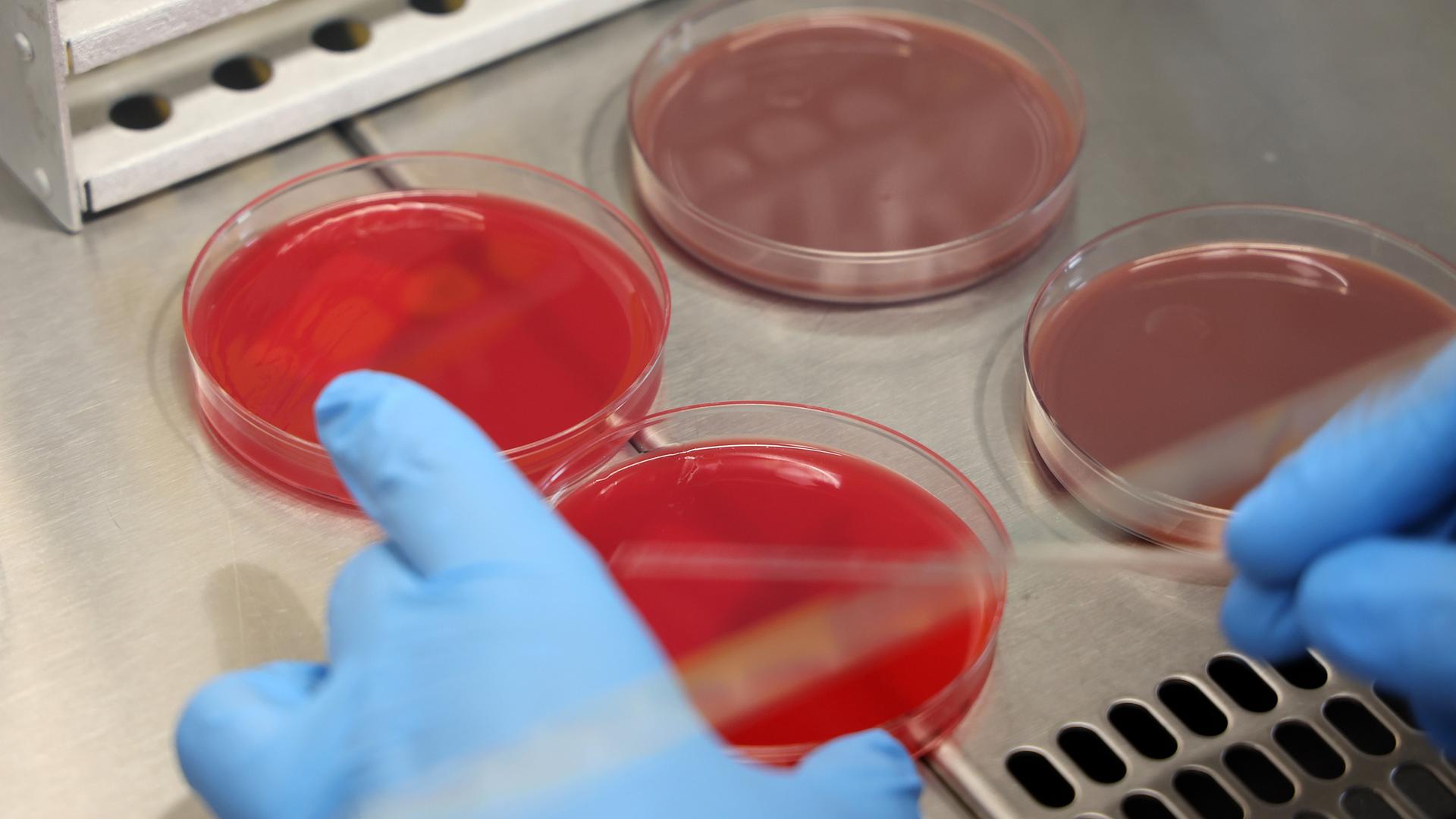 Zwei behandschuhte Hände bereiten in einem Labor etwas für die kulturelle Anzucht von Bakterien und Pilzen vor.