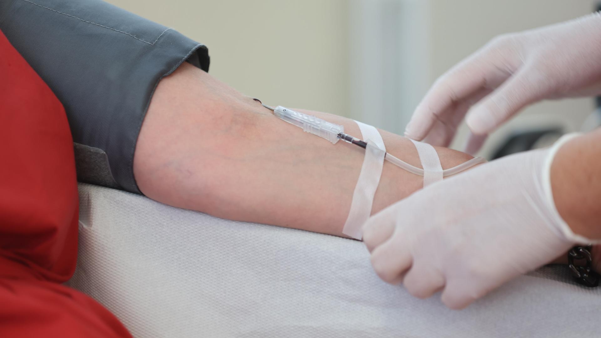 Eine Venenkanüle ist bei einer Blutspende am Arm eines Spenders fixiert. Eine Venenkanüle ist bei einer Blutspende am Arm eines Spenders fixiert.