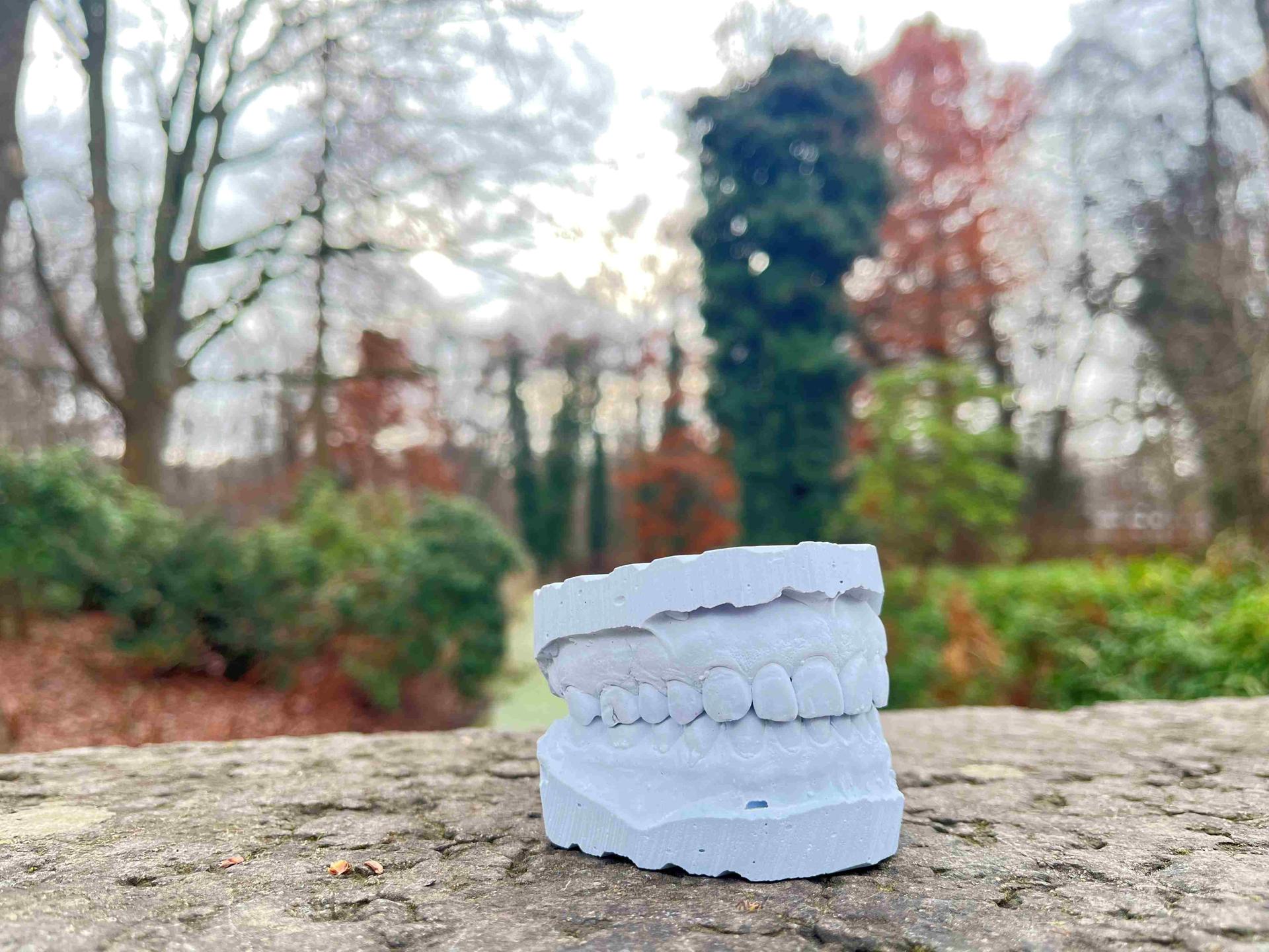 Ein Gipsabdruck eines Gebisses auf einer Mauer in der Landschaft