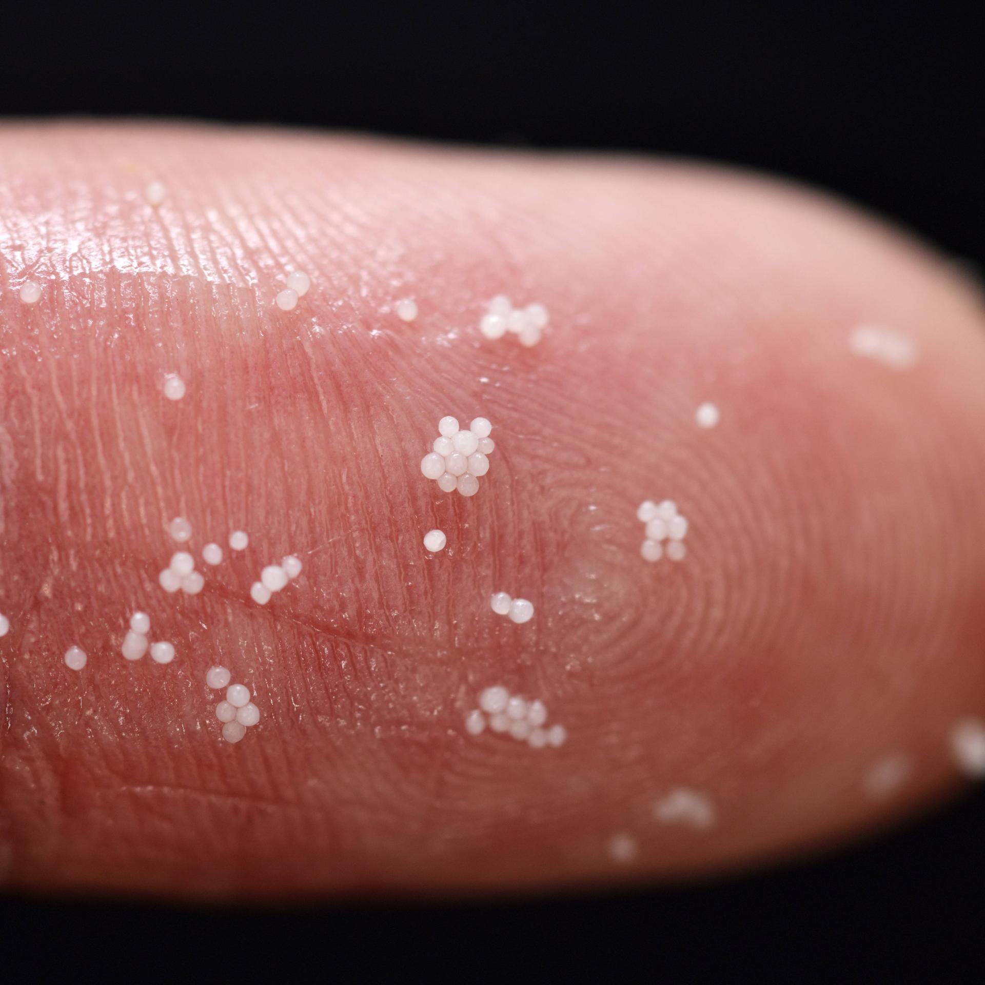 Mikroplastik - Keine Kausalität für erhöhte Tumorgefahr im Gehirn