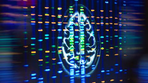 Ein MRT-Scan des Gehirns in der neurologischen Forschung