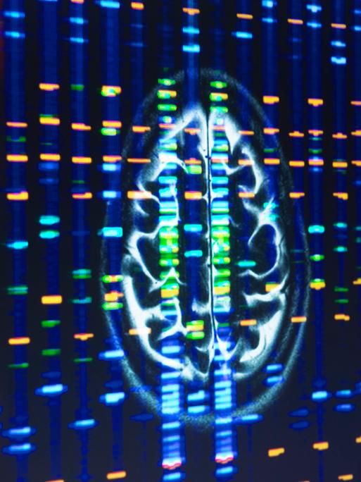 Ein MRT-Scan des Gehirns in der neurologischen Forschung