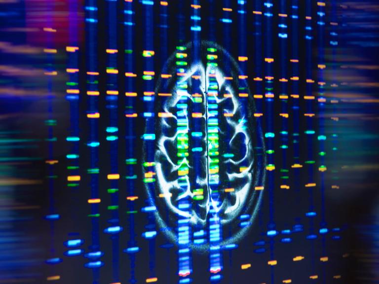 Ein MRT-Scan des Gehirns in der neurologischen Forschung