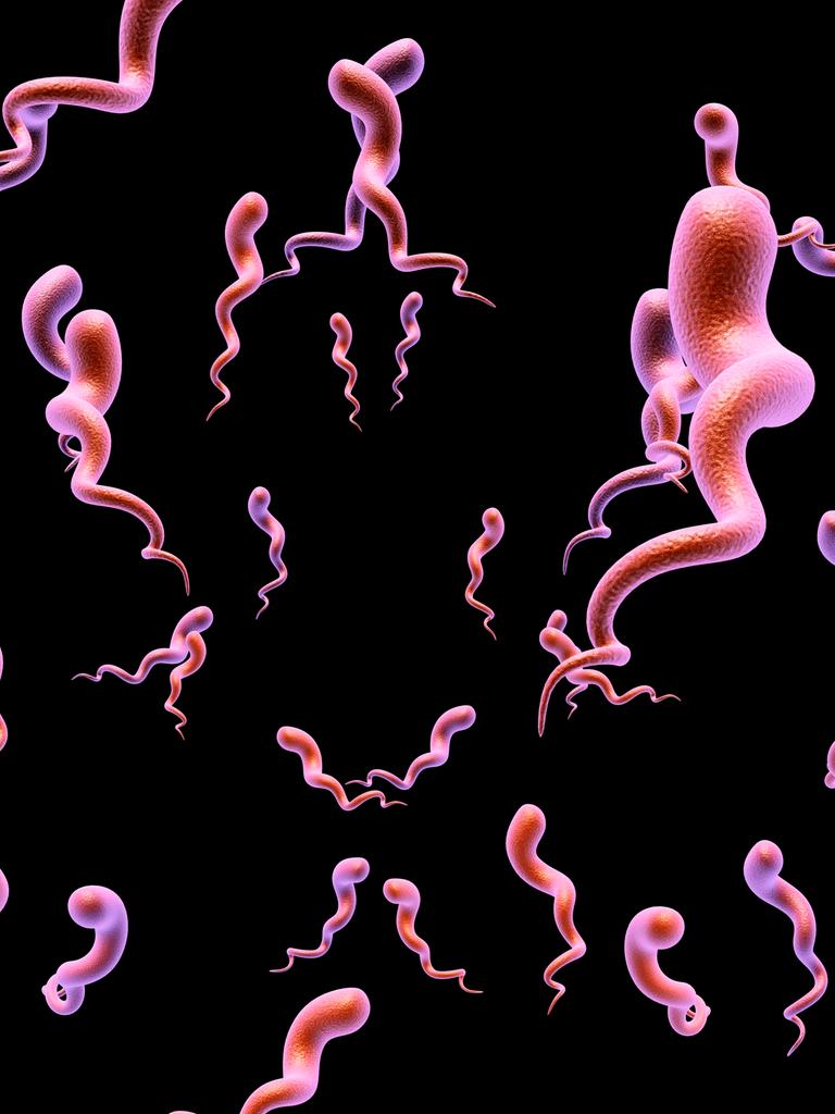 Illustration des Syphilis-Bakteriums. Rosa gekringelte Bakterien schweben vor schwarzem Untergrund.