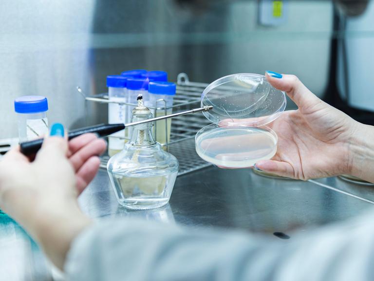 Eine Frau mit blauem Nagellack hält mit der rechten Hand eine Petrischale. Mit der linken führt sie eine Pipette, mit der sie vermutlich etwas in die Schale füllt. 