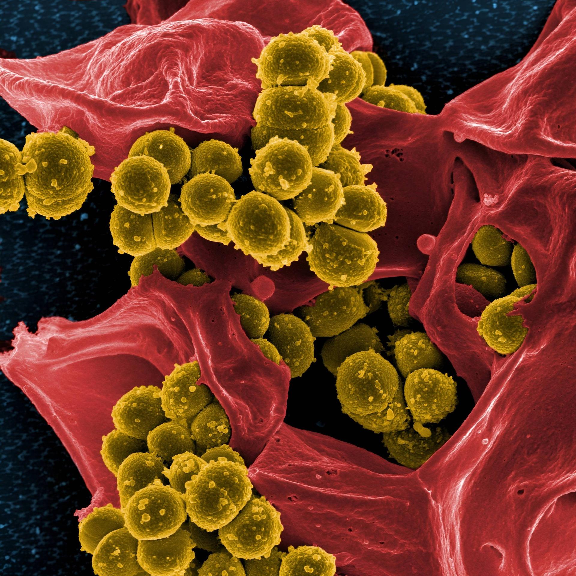 Medizin - Wie KI neue Antibiotika finden soll