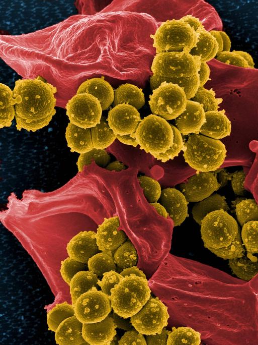 Farbig nachbearbeitete elektronenmikroskopische Aufnahme von methicillin-resistenten Staphylococcus-aureus-Bakterien (MRSA). Die kugelförmigen Bakterien sind gelb dargestellt. Daneben ist eine abgestorbene menschliche weiße Blutzelle in Rot zu sehen.