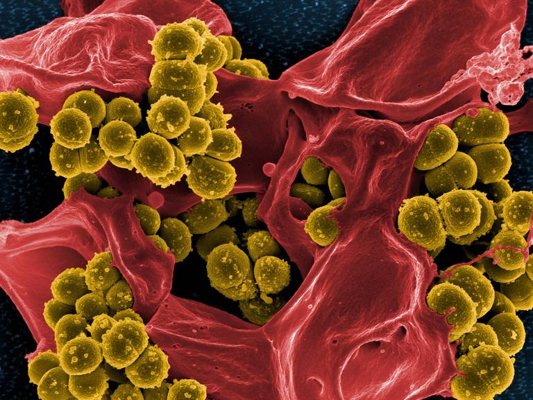 Farbig nachbearbeitete elektronenmikroskopische Aufnahme von methicillin-resistenten Staphylococcus-aureus-Bakterien (MRSA). Die kugelförmigen Bakterien sind gelb dargestellt. Daneben ist eine abgestorbene menschliche weiße Blutzelle in Rot zu sehen.