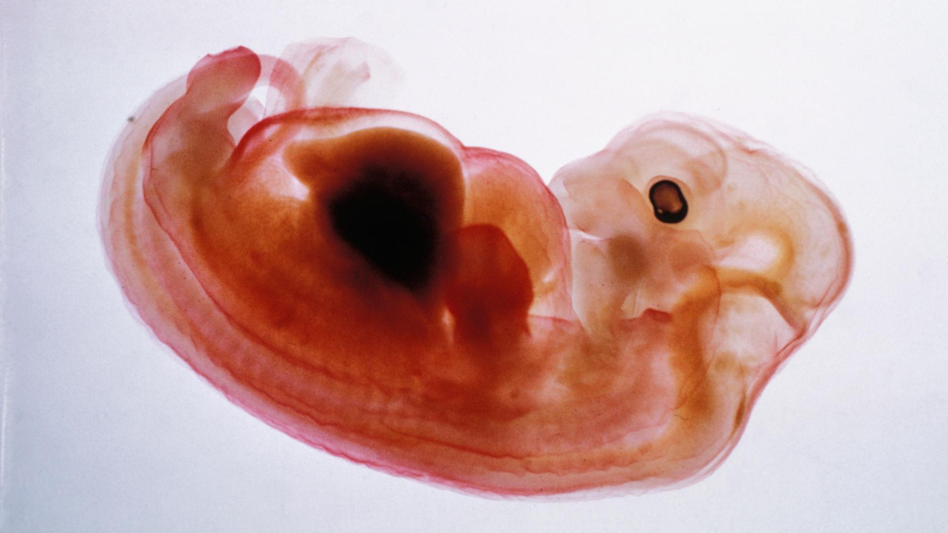 Schweineembryo mit menschlichen Zellen.