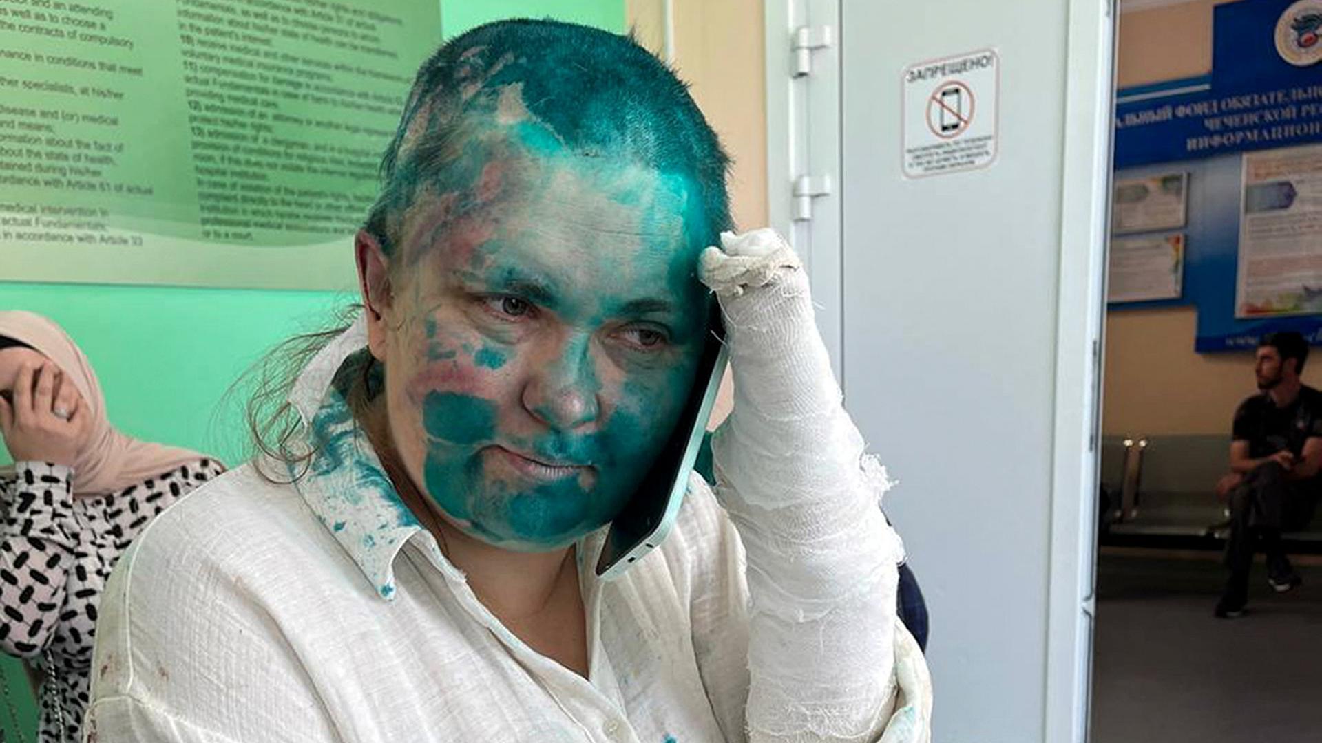 Milaschina sitzt mit ernstem Blick in einem Raum auf einer Liege und telefoniert mit einem Handy. Ihre Hände sind verbunden. Ihr Gesicht und ihr weißes Hemd sind mit grüner Farbe beschmiert. Hinter ihr sitzt eine Frau mit Kopftuch, die ihr Gesicht mit der Hand verdeckt.
