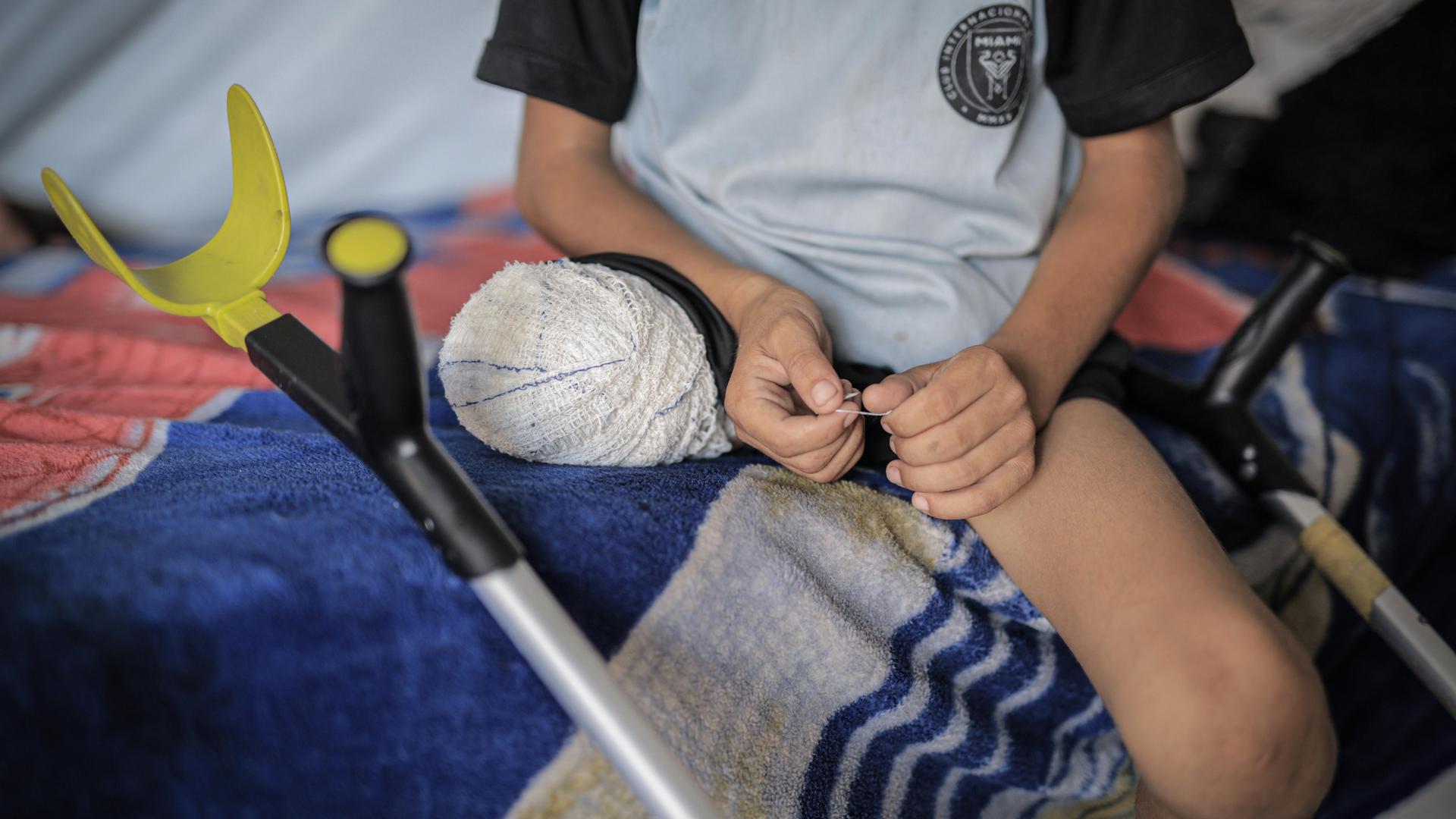Ein Junge mit nur noch einem Bein sitzt auf einem Bett, seine Gehhilfe liegt neben ihm.