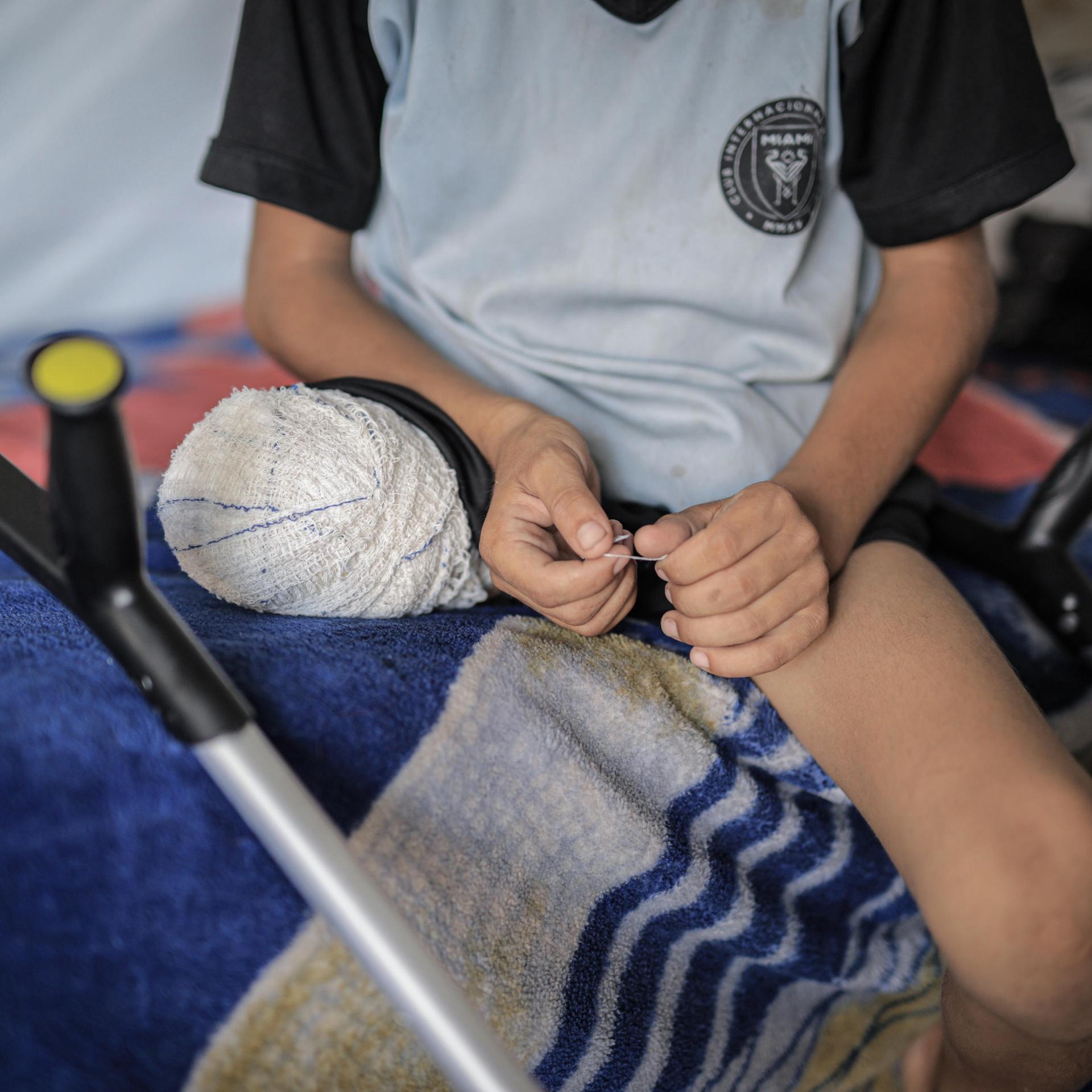Ein Junge mit nur noch einem Bein sitzt auf einem Bett, seine Gehhilfe liegt neben ihm.