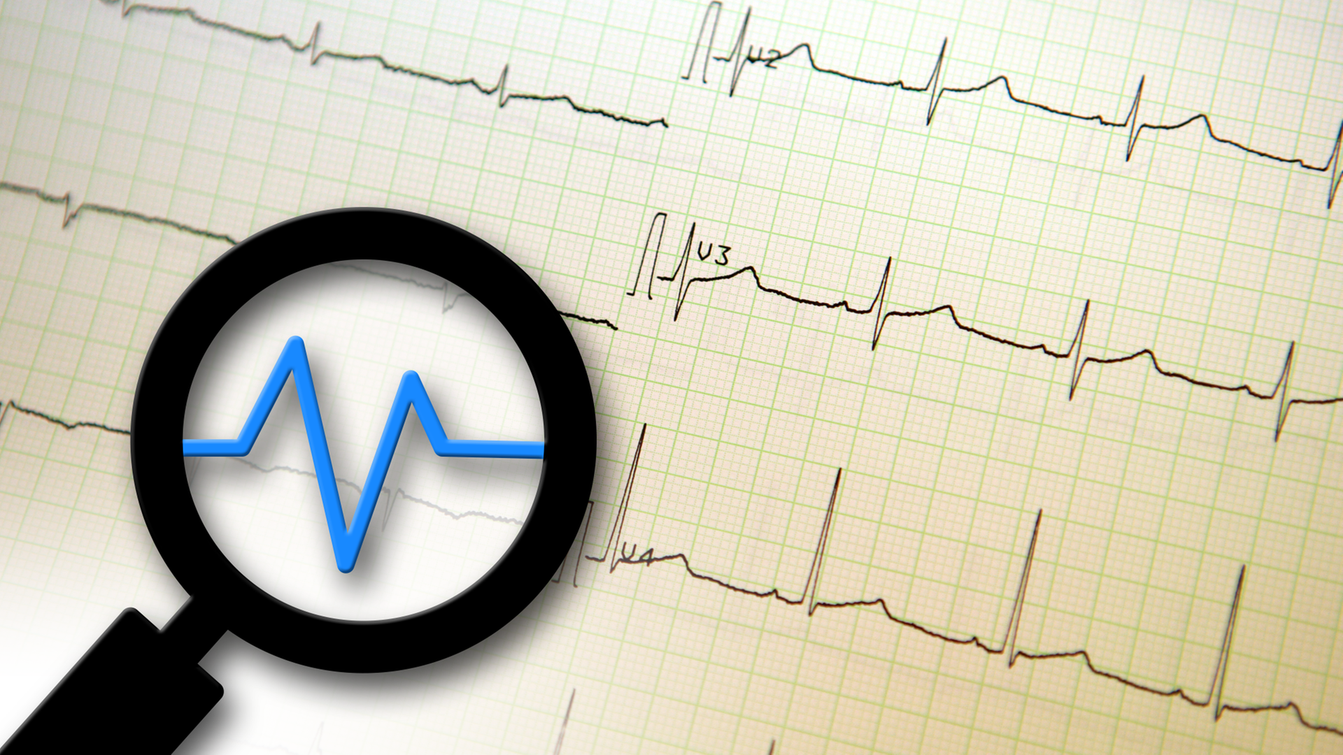 EKG EKG