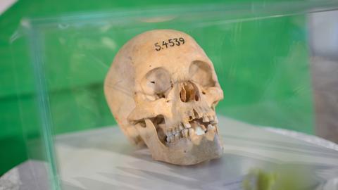 Ein menschlicher Totenschädel, auf dessen Stirn die Ziffernfolge 5.4539 aufgetragen ist, liegt, von einem Glaskasten geschützt, auf einem Podest mit weißem Tischtuch.