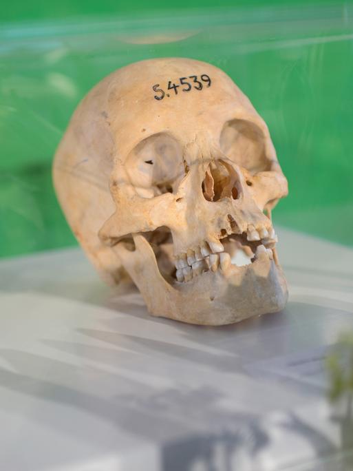 Ein menschlicher Totenschädel, auf dessen Stirn die Ziffernfolge 5.4539 aufgetragen ist, liegt, von einem Glaskasten geschützt, auf einem Podest mit weißem Tischtuch.