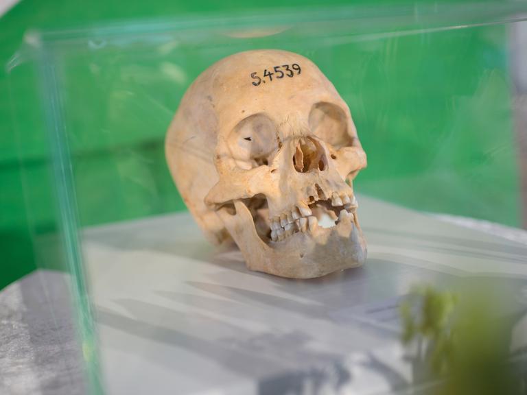 Ein menschlicher Totenschädel, auf dessen Stirn die Ziffernfolge 5.4539 aufgetragen ist, liegt, von einem Glaskasten geschützt, auf einem Podest mit weißem Tischtuch.
