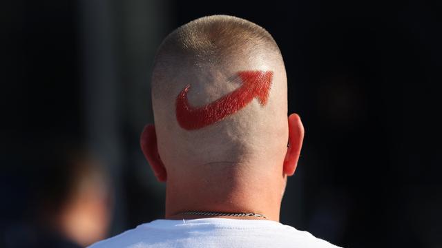 Ein AfD-Anhänger mit einem frisierten Logo der Partei auf dem Hinterkopf, nimmt an der Abschlusskundgebung der AfD Sachsen-Anhalt auf dem Domplatz in Magdeburg teil.